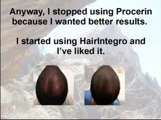 Does Procerin Work?  Procerin Reviews