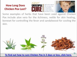 How Long Does Chicken Pox Last