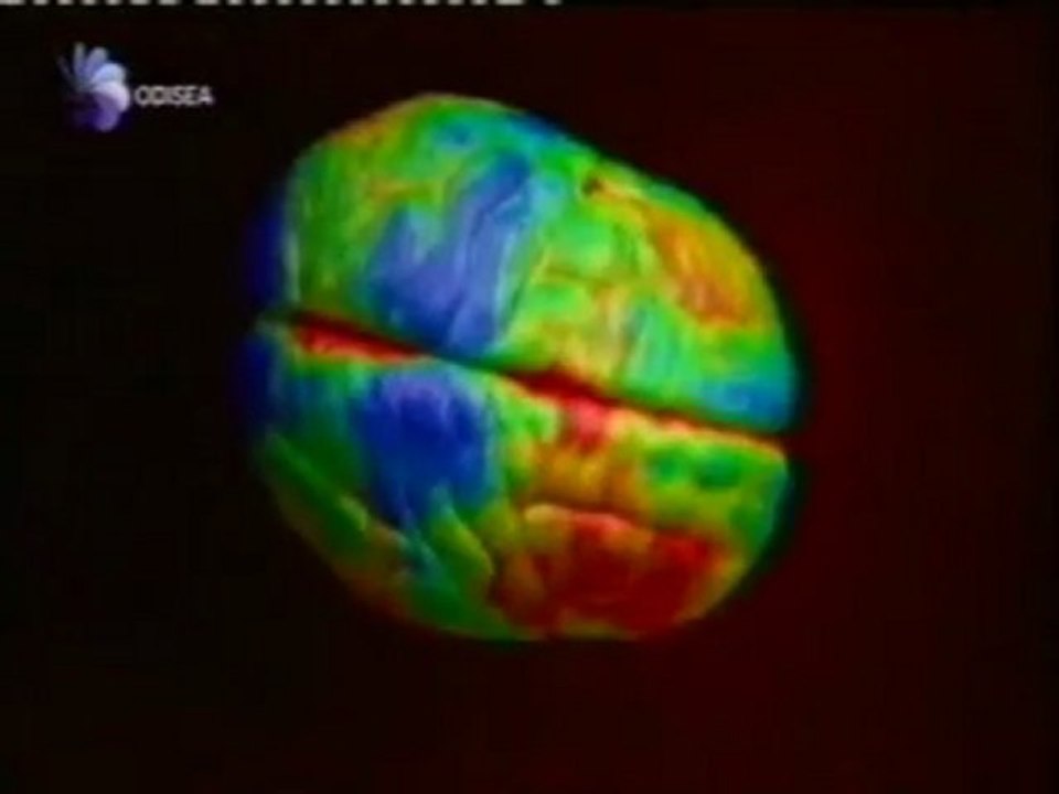 Pubertad y riesgo: Lobulo frontal