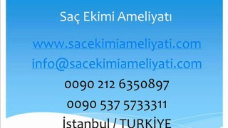 Fue Saç Ekimi Fiyatı,Saç Ekimi Video İzle,Saç Ekimi Fiyatları,Saç Dökülmesi,Sac Ekimi Türkiye