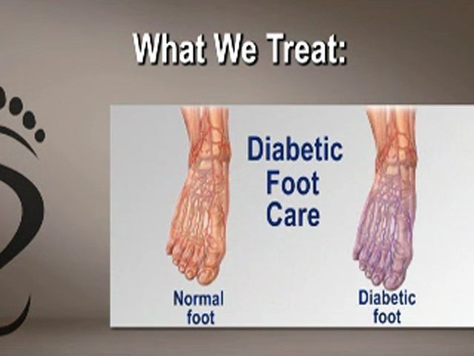 Joel Feder, DPM and Marc Feder, DPM - Podiatrist Chicago, Six Corners, Northwest Side