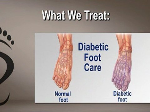 Joel Feder, DPM and Marc Feder, DPM - Podiatrist Chicago, Six Corners, Northwest Side