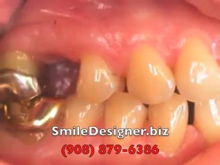 More Chester Dental Associates Reviews