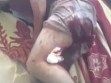 Syria فري برس اللاذقية قرية دفيل اصابة بالفخذ 5 6 2012 Latakia