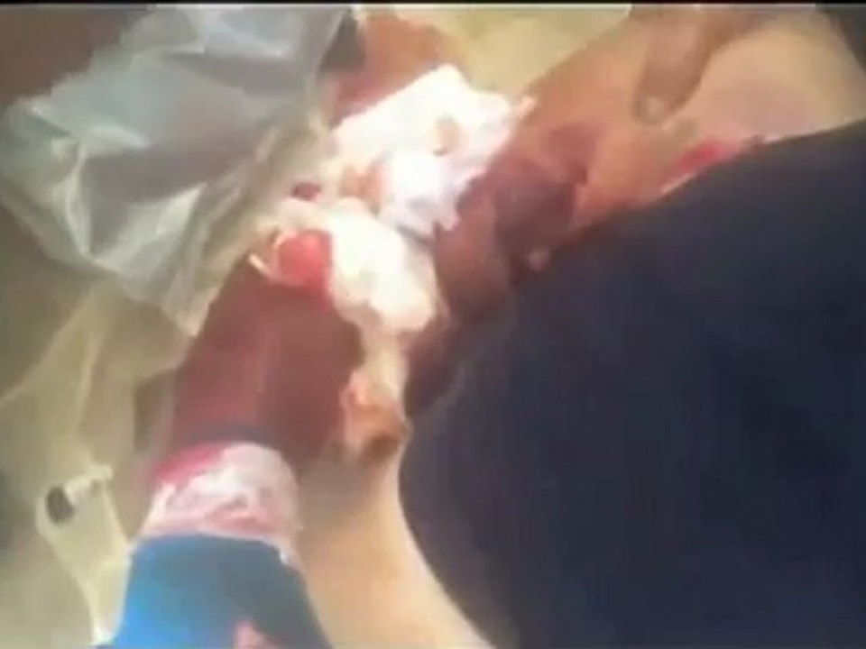 Syria فري برس اللاذقية الحفة احدى الاصابات 5 6 2012 Latakia