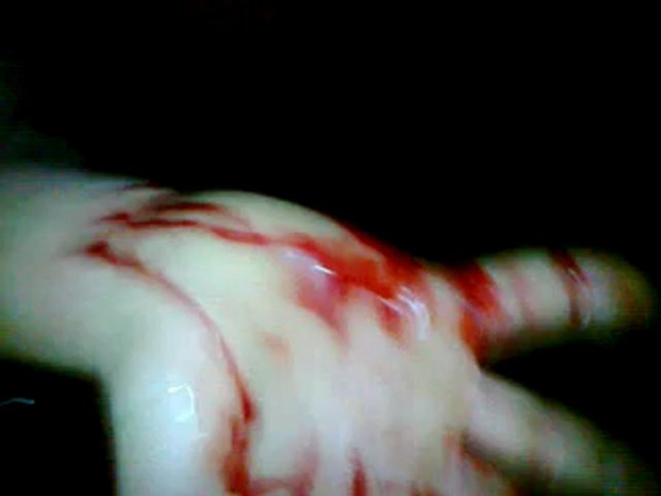 Wutzausfall 'nicht feiern ist gefährlich'