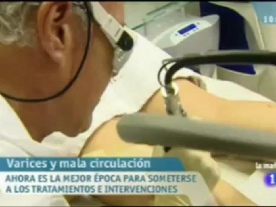 Eliminar varices con laser en Madrid