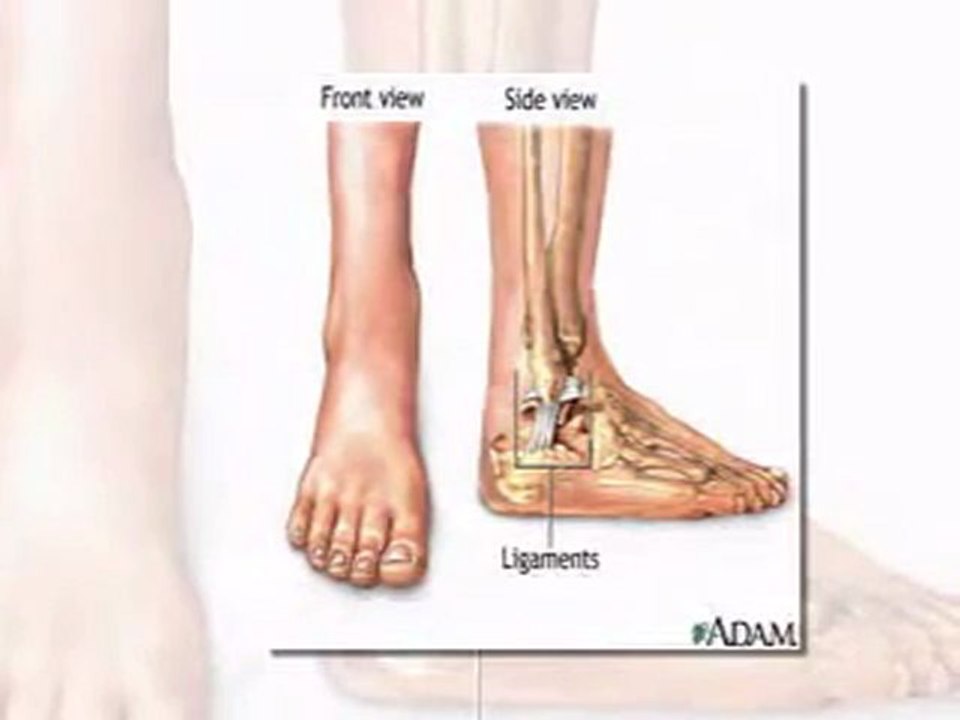 Sprained Ankle Treatments