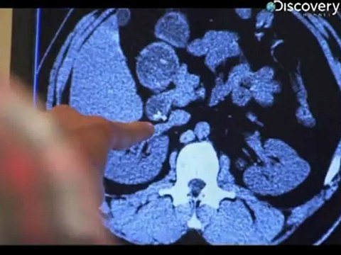 Stan Lee's Superhumans Jaw Breaker