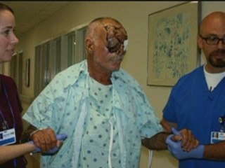Photos released of face-chewing victim in Miami