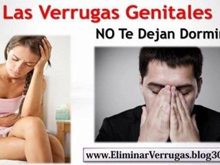 Download Video: Verrugas Genitales En Hombres - Como Eliminar Verrugas