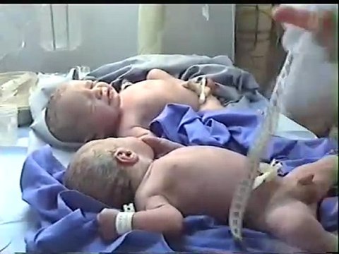 naissance de Mathys et Sacha