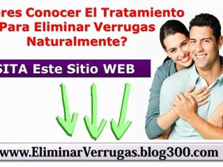 Download Video: Quitar Verrugas De Las Manos - Eliminar Las Verrugas Genitales