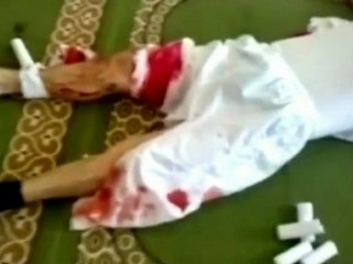 Wounded in Syria
