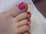 Toenail Restoration - Podiatrist in Massapequa, NY - Corey Fox DPM