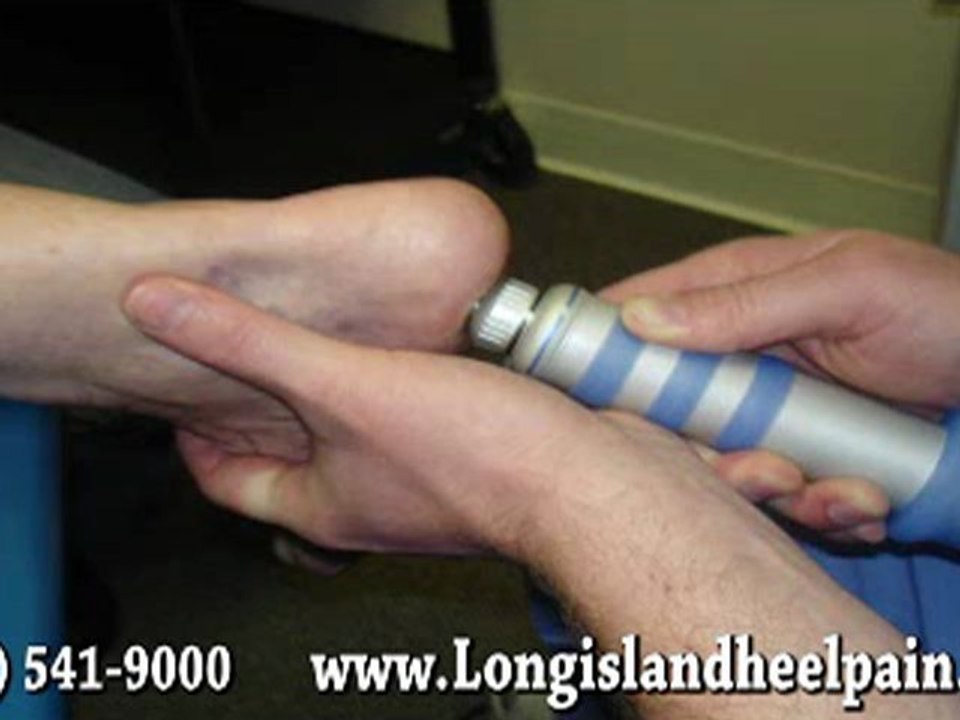 Shockwave Therapy for Heel Pain - Podiatrist in Massapequa and Nassau County, NY