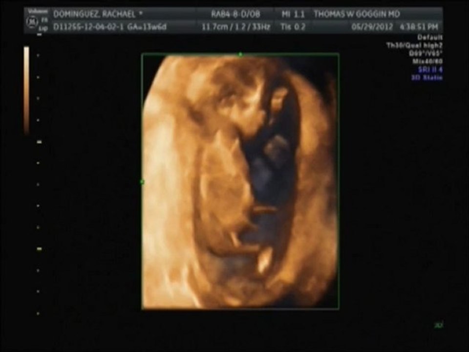 baby2