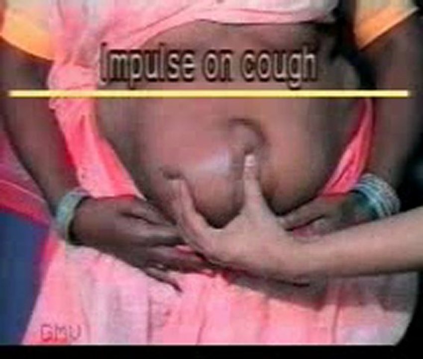 Examination of  SWELLING