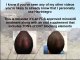 Hairmax Lasercomb Review - Hair Loss Laser Comb Reviews