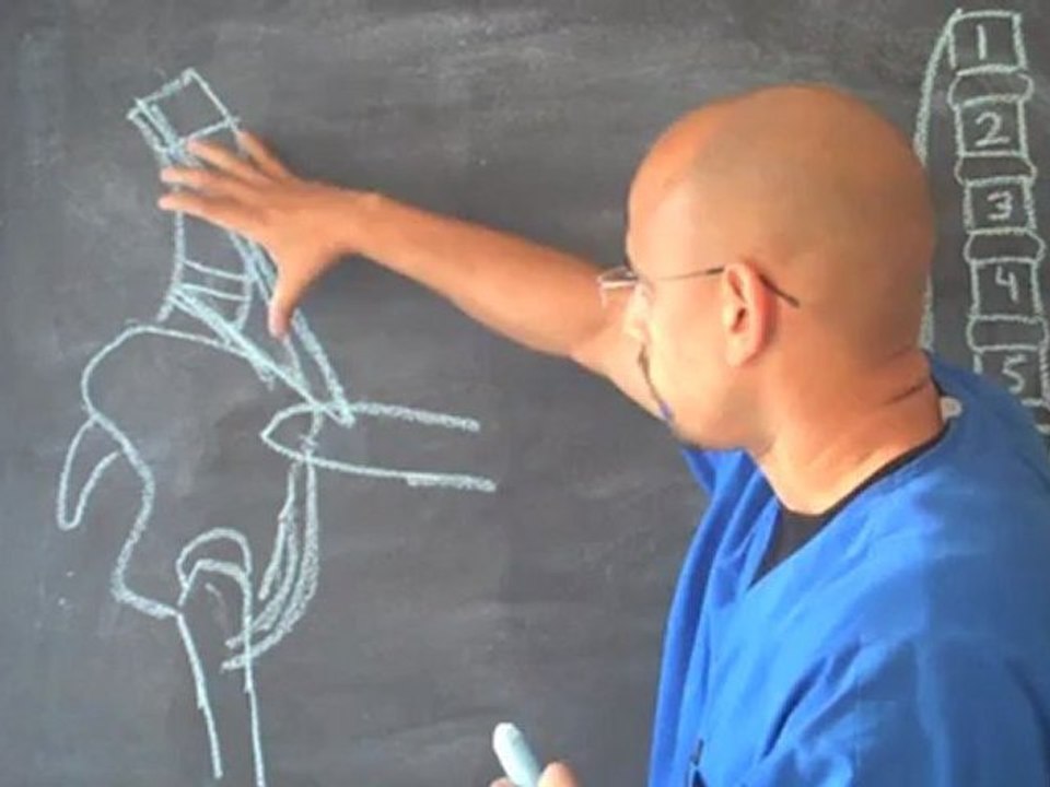 Quiropractico Atlanta / Gainesville GA - Estire Este Musculo Para Aliviar el Dolor de Espalda Baja - Quiropractico Gainesville GA