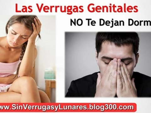 Como Eliminar Verrugas En La Cara - Como Quitar Los Lunares De La Cara