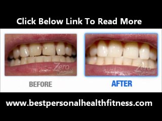 How Zero Peroxide Help Whiten Stained Teeth Naturally at Home