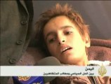 معاناة سكان شمال العاصمة اليمنية من الألغام
