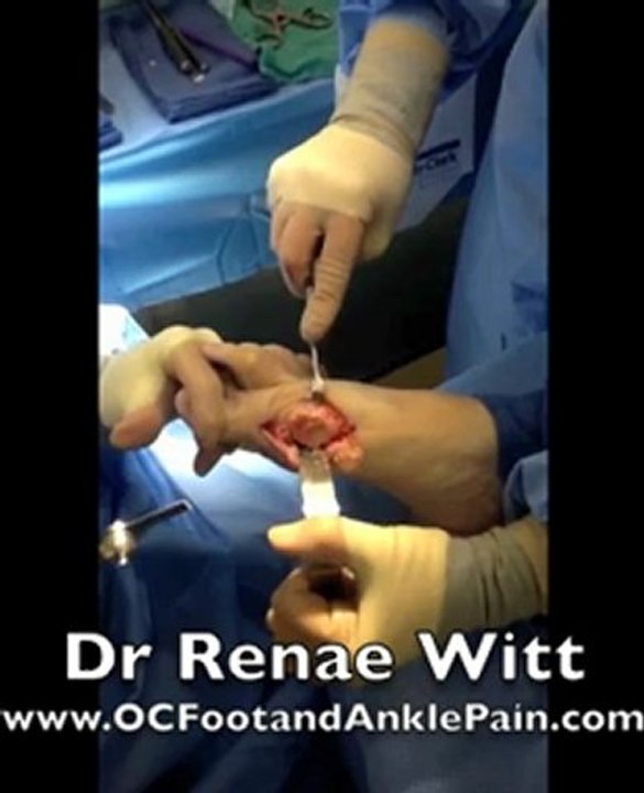 Foot and Ankle Specialist 657-206-0664 Costa Mesa CA