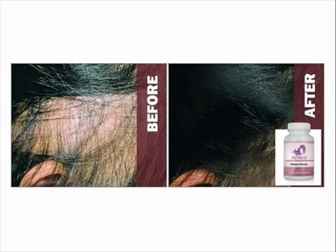 Provillus | Provillus for Men | Provillus for Women