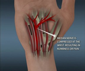 Middletown NJ Pain Management, 732 671-3535