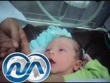 معجزة طبية بالاسماعيلية ولادة طفل خارج الرحم