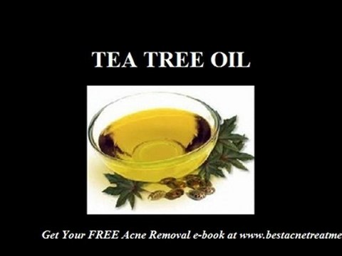 EFFECTIVE TREATMENTS FOR ACNE BLEMISHES NO ONE HAS TOLD YOU