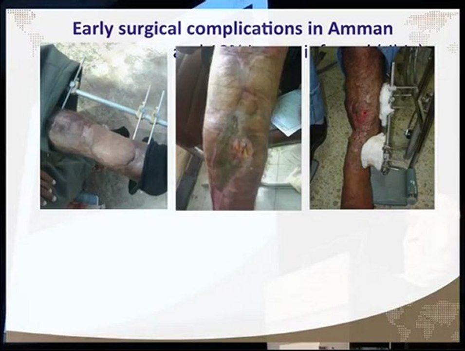 Epicentre Journée Scientifique 2012 - Rasheed FAKHRI