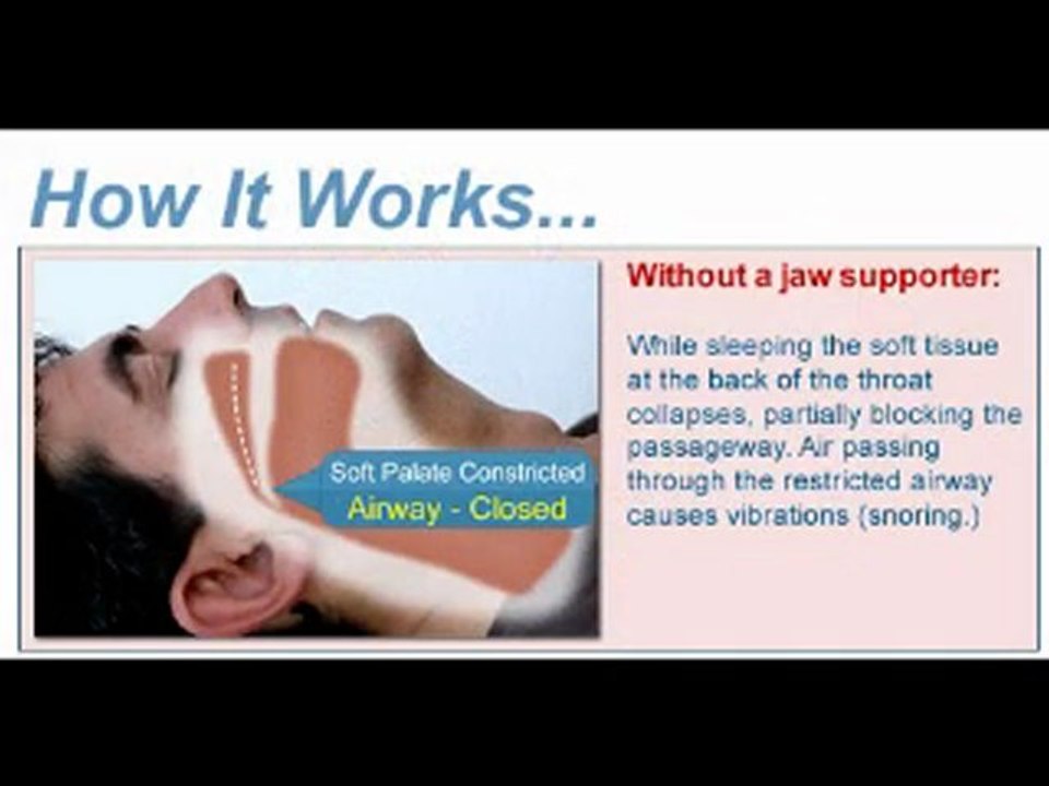 How to stop snoring