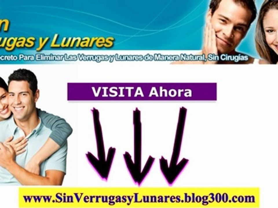 Como Quitar Mis Lunares - Como Eliminar Mis Verrugas