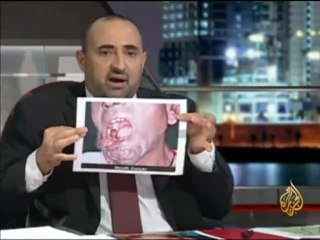 الإتجاه المعاكس - لقطات من حلقات متنوعة لعام 2010