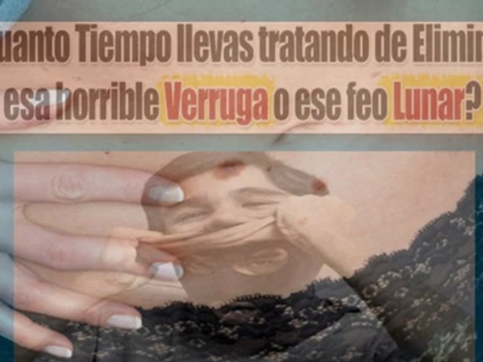 Verrugas Vulgares Tratamiento - Verrugas En Los Parpados