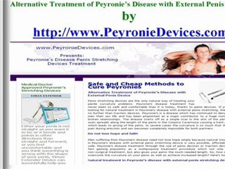 Peyronie's Disease Treatment Stretching Review