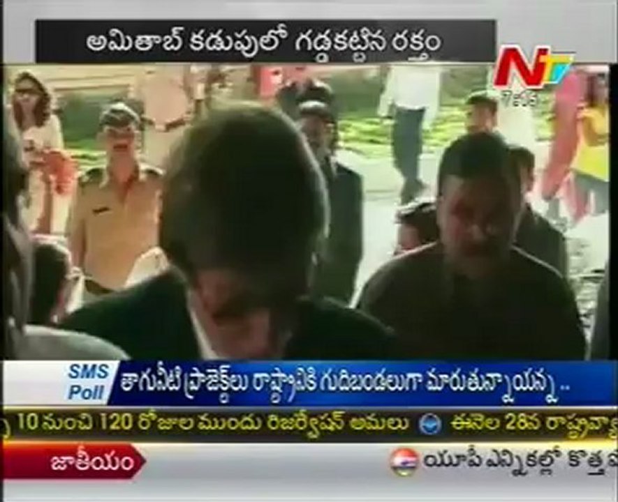 Amitabh Bachchan Undergo Second Surgery