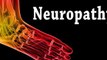 Peripheral Neuropathy - Podiatrist - Fort Myers, Cape Coral,  Lee County, Fl