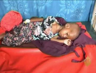 معاناة الأطفال المتضررين من الجفاف بالصومال