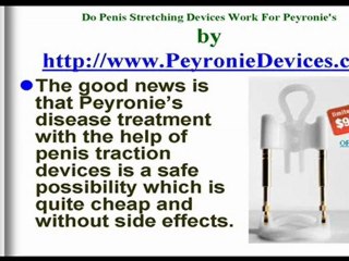 Do Penile Stretching Devices Work For Peyronie's?