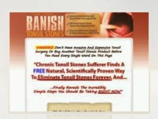 how to get rid of tonsil stones