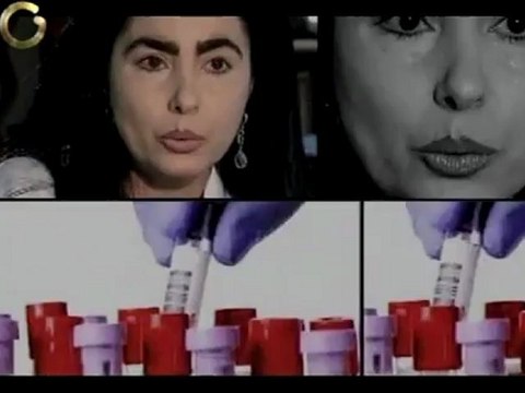 Saber Vivir: ¿Cómo manejar el acné en la etapa adulta?