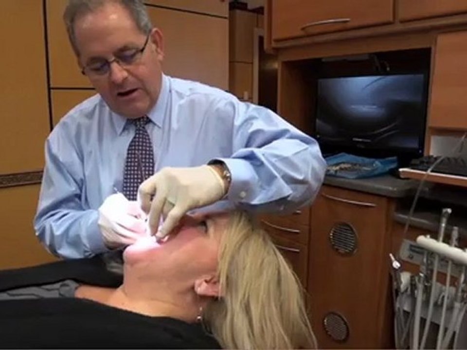 Porcelain Veneers - Cosmetic Dentists Ellenton, FL