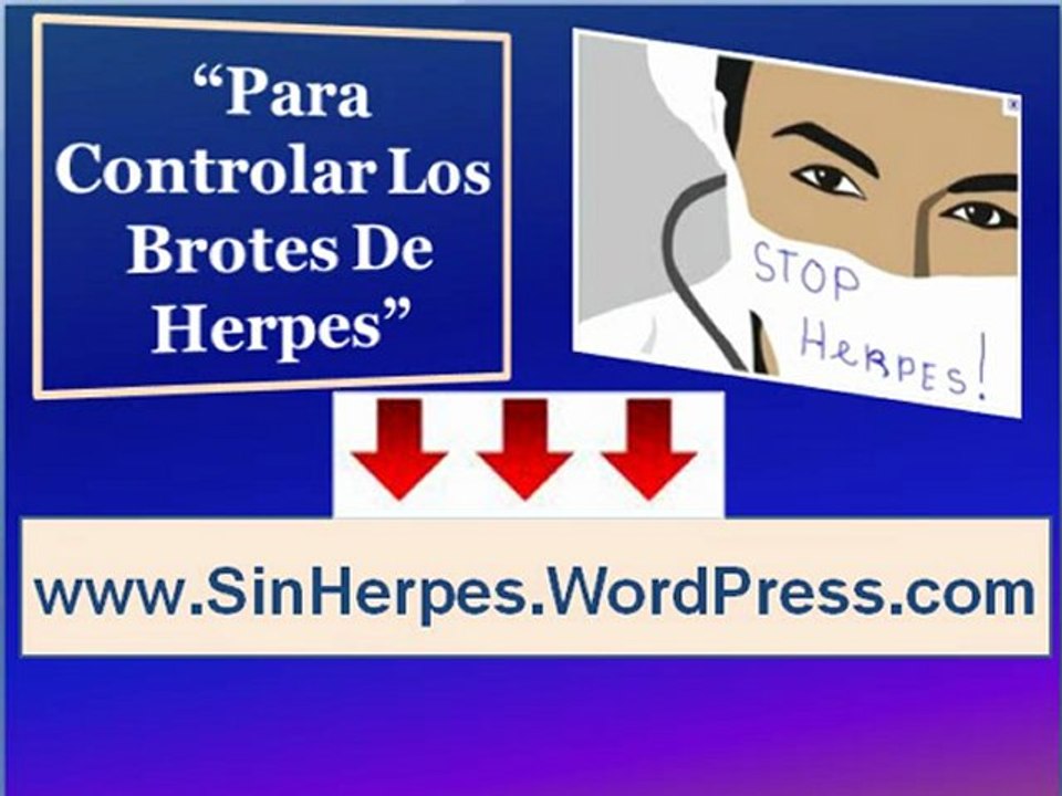 Como terminar con el herpes | Como controlar los brotes de herpes