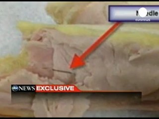 Uçakta iğne paniği