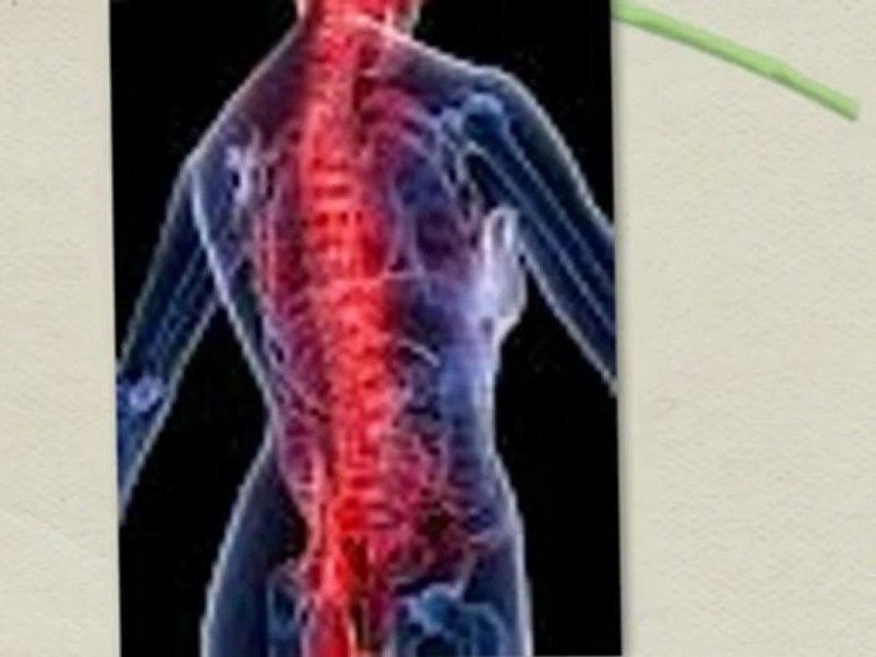 Baldwin Park Chiropractor - Yepez and Contreras Life Fitness- 626-337-4000 Free Consultation