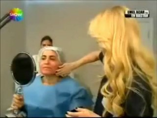 lazerle  cilt gençleştirme