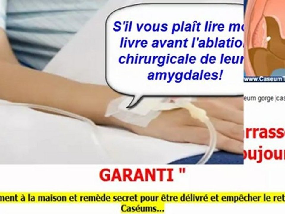 amygdales infectées - amygdales symptomes - amygdales cerveau